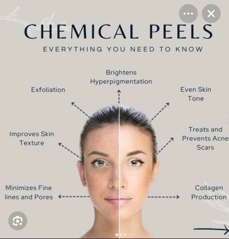 Chemical Peel at Blooms & Beauty Esthetics INC in Orlando, FL
