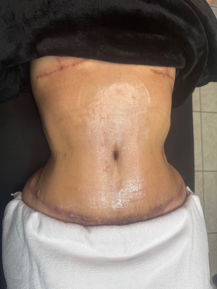 Post Op Treatment (10 Sections)