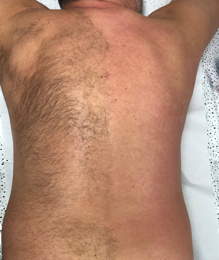 Back Waxing