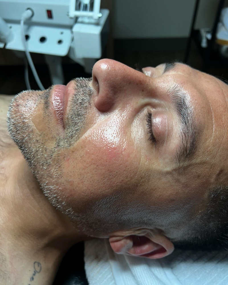 Oxygen X Enzyme Treatment
