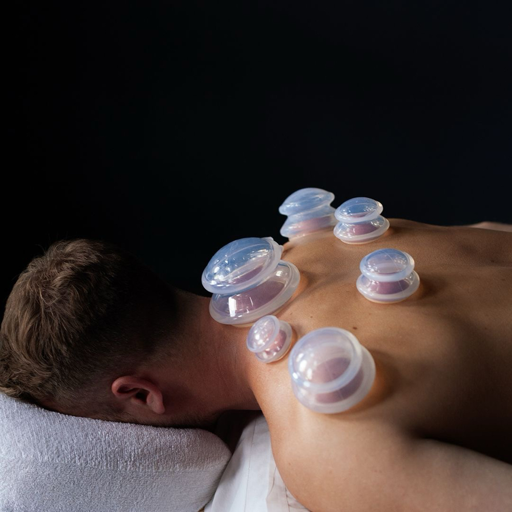 60 minute Cupping Therapy