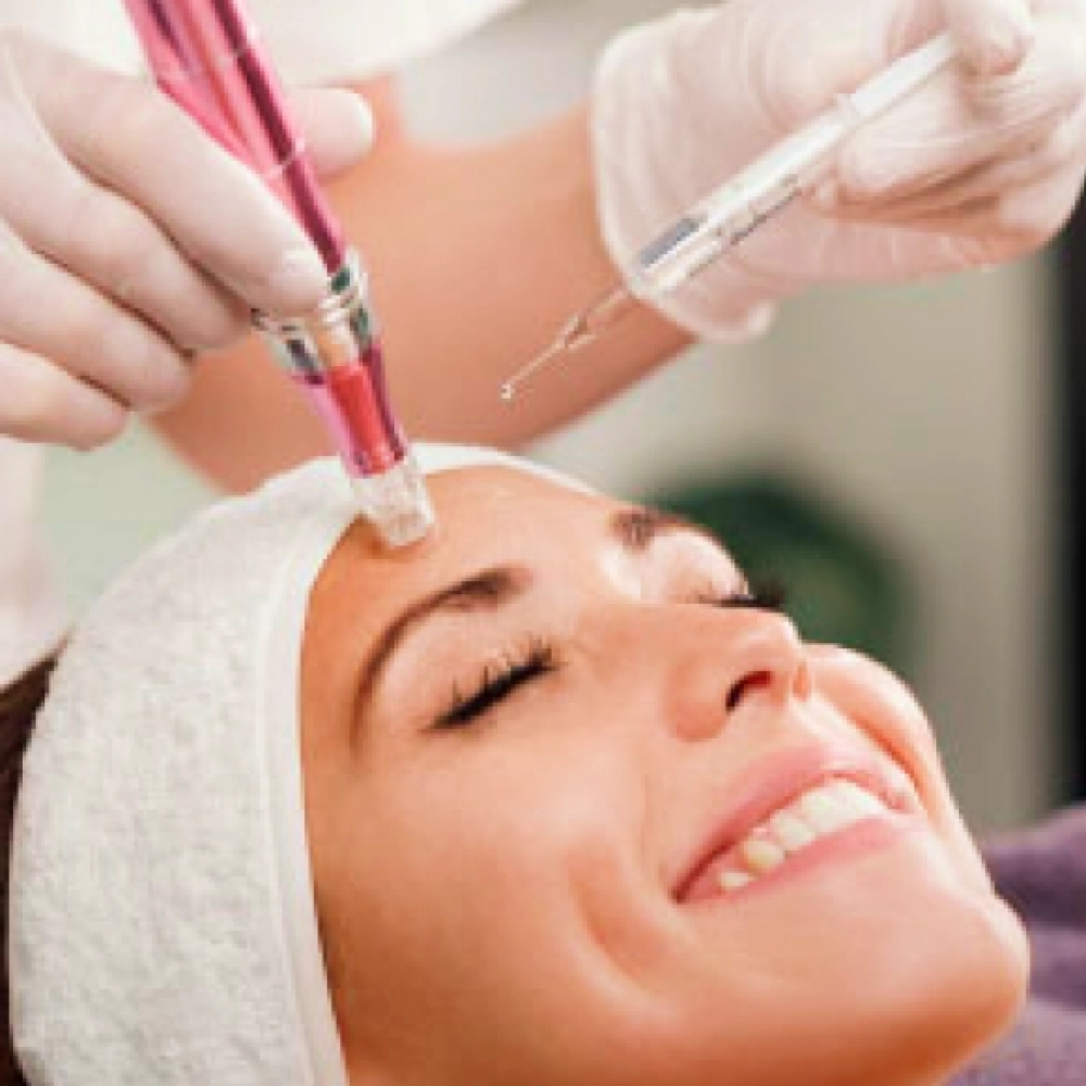 Microneedling Facial at Timeless Beauty Esthetics in Fayetteville, NC