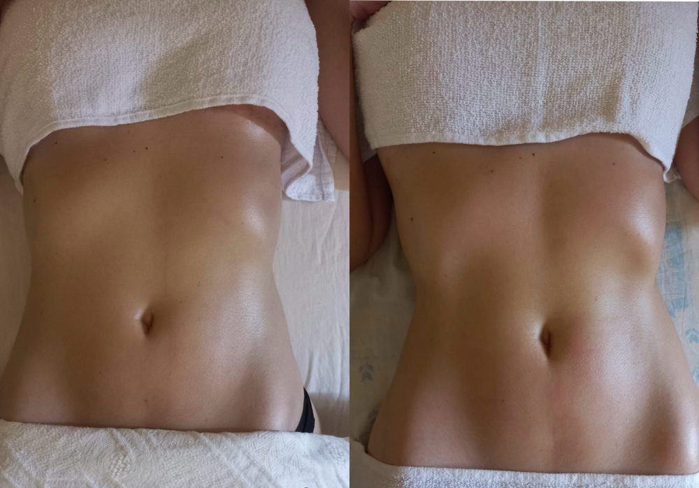 Manual Lymphatic Drainage - Special