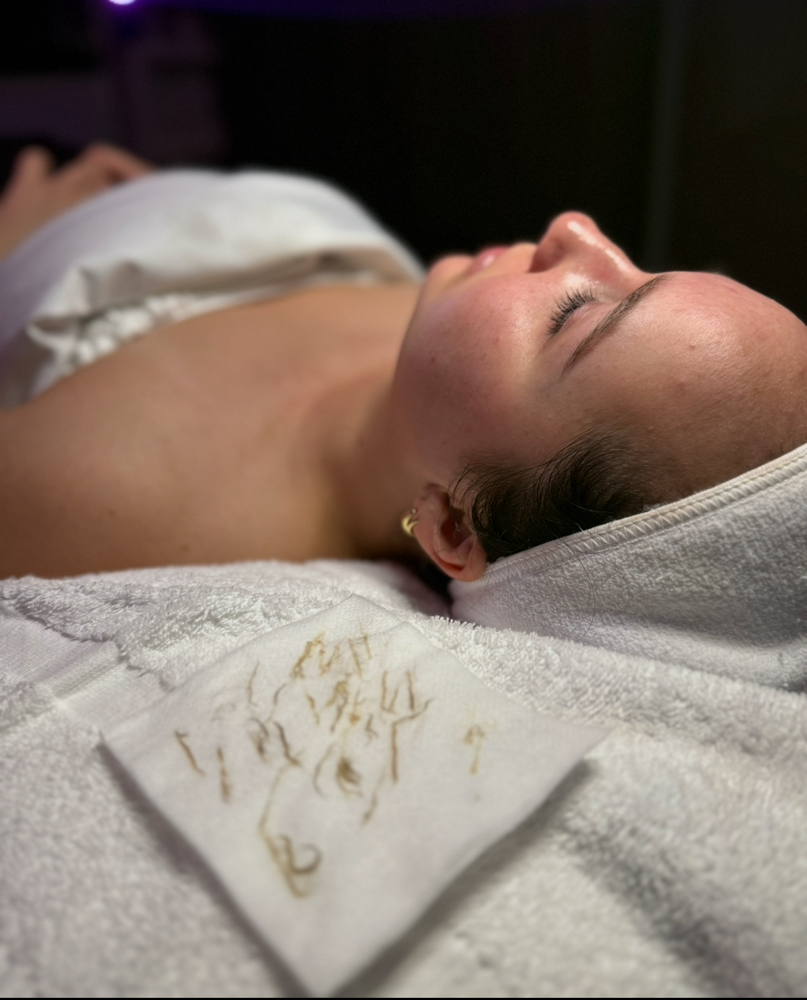 Dermaplane Facial
