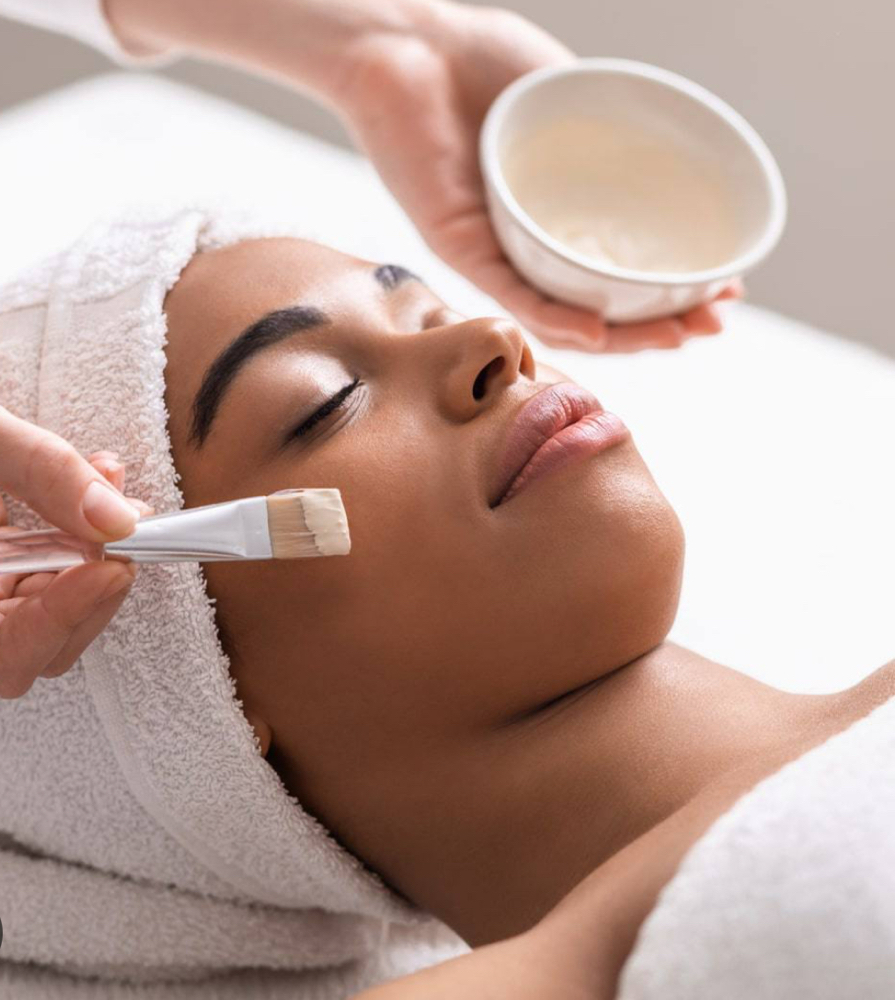 Chemical Peel