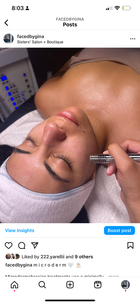 Microdermabrasion Facial