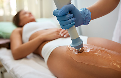Cellulite reduction treatment