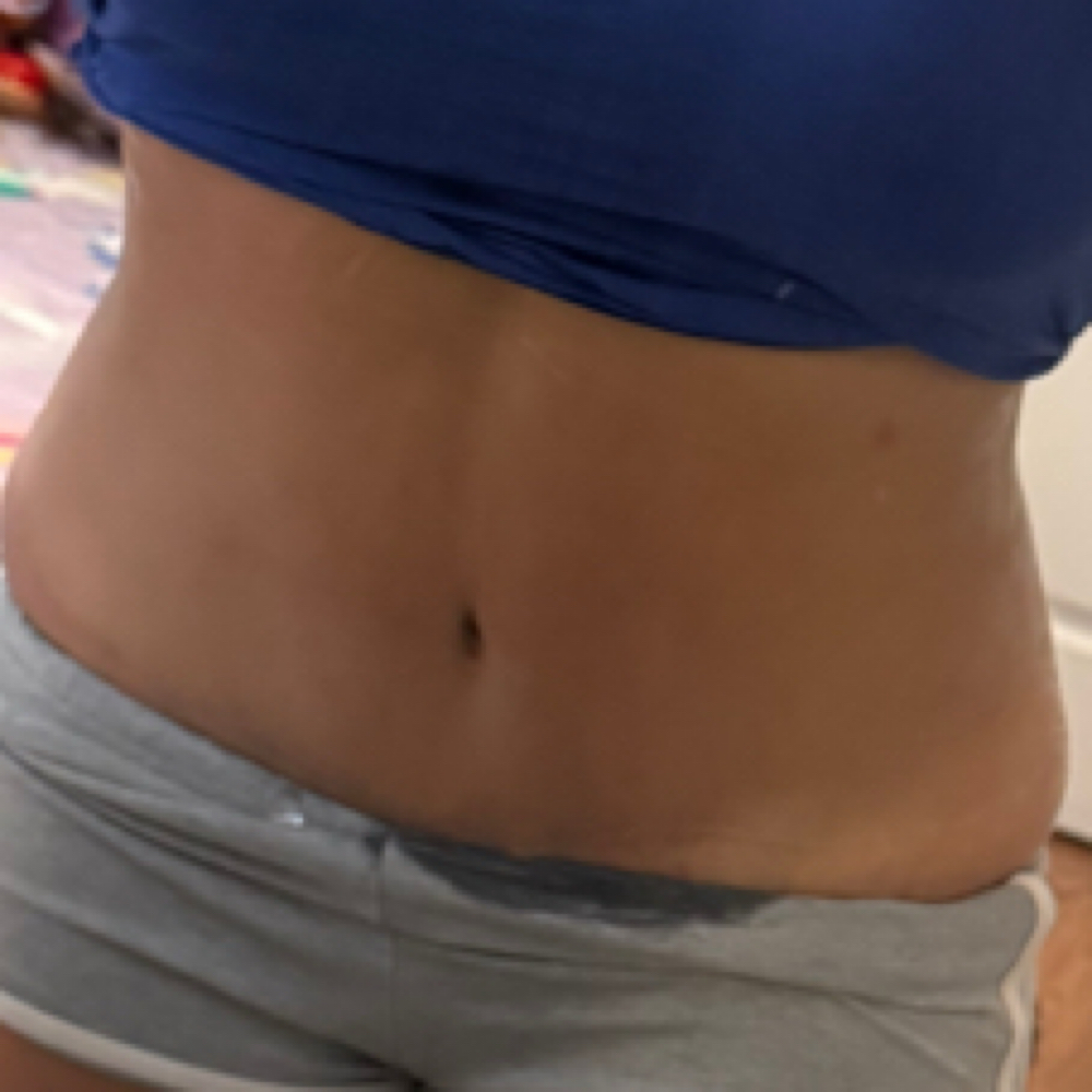 Stomach Cavitation at Wendy’s Beauty bomb Spa in Chino, CA