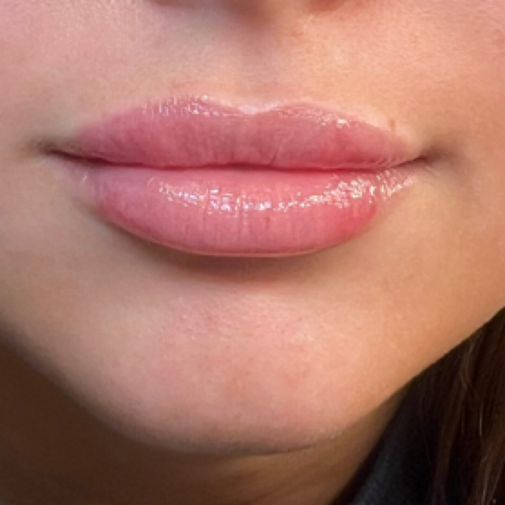 Mini Lip Plump at The Tox Haus in Terrell, TX