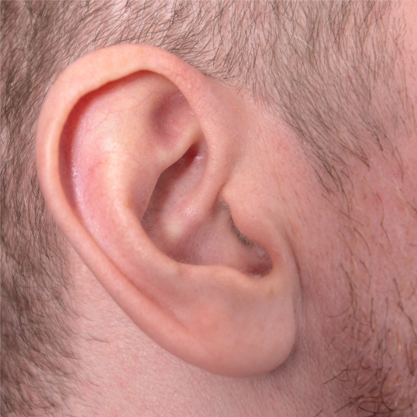 Ears at Bareline Aesthetics in Brea, CA