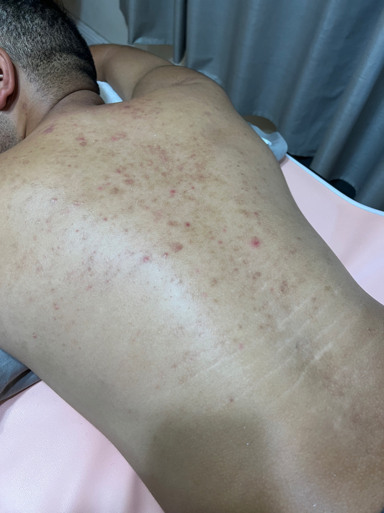 Back Wax