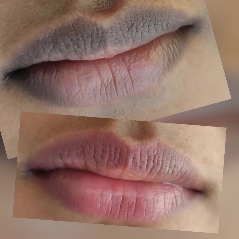Lip Naturalization at Signature-PMU By Tara in Johns Creek, GA