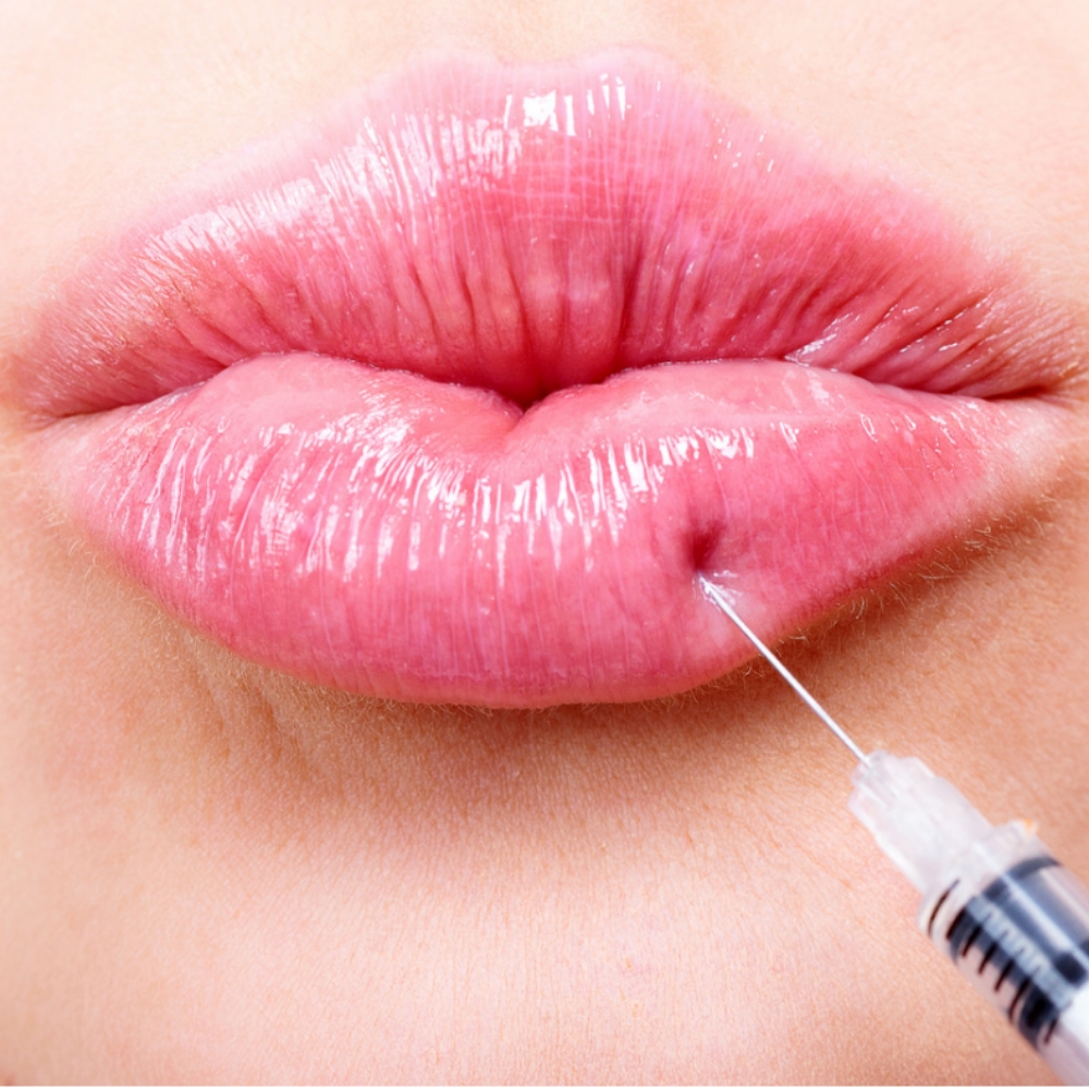 Signature Lip (Full Syringe) at Skin by Jessica in somerset, KY