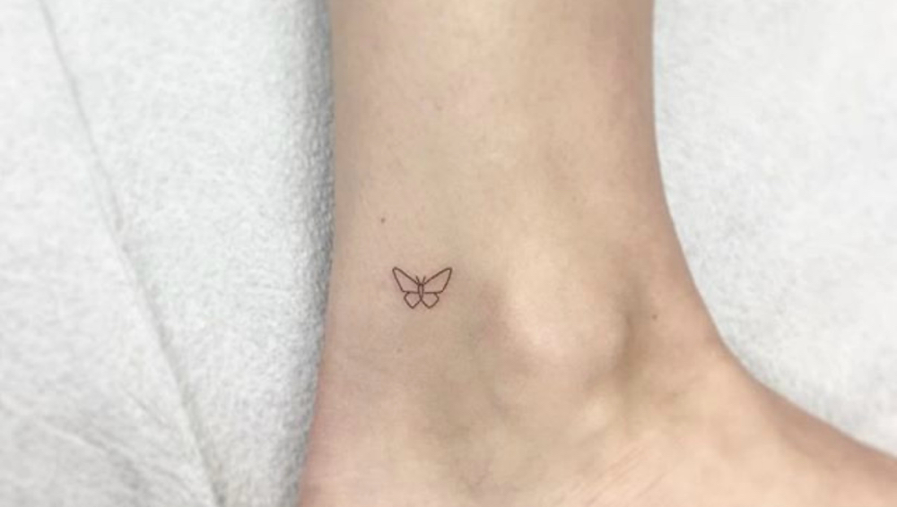 XX Small Laser Tattoo Removal