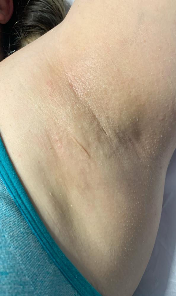 Underarm wax