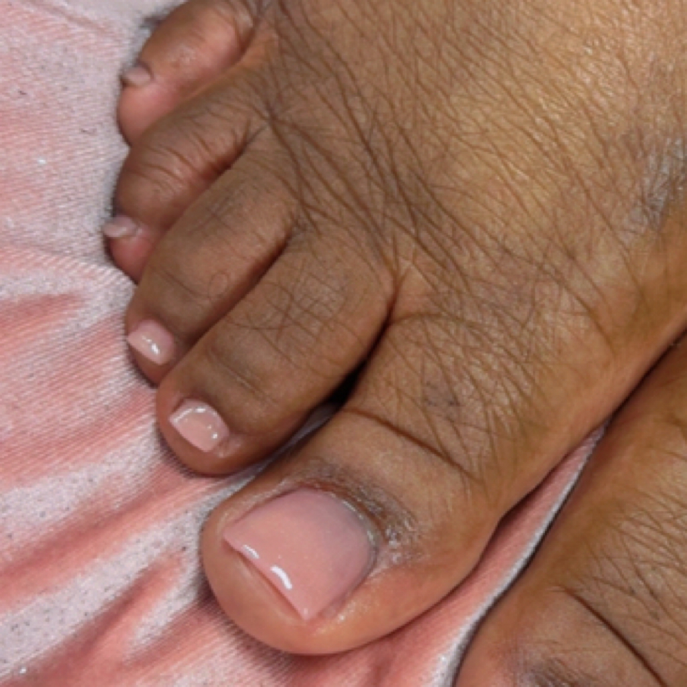Toenail Acrylic at Dee Did’em in Kinston, NC