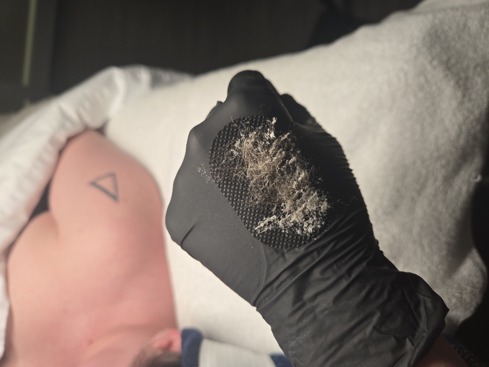 Dermaplaning Add On