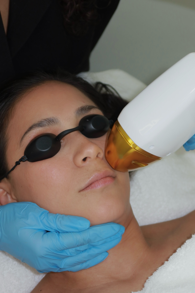 Upper Lip/Labio Superior