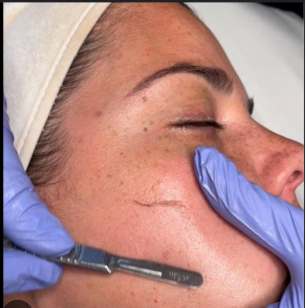 Dermaplane Pro 90 Minute Facial