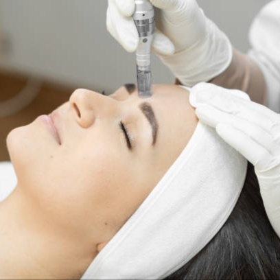 Micro-Needling Facial - 60 Minutes at Sheri  Day Spa by the Sea in Morehead City, NC
