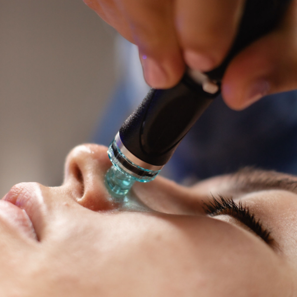 Hydrafacial Extraction Enhancement at Skin Seed in Turlock, CA