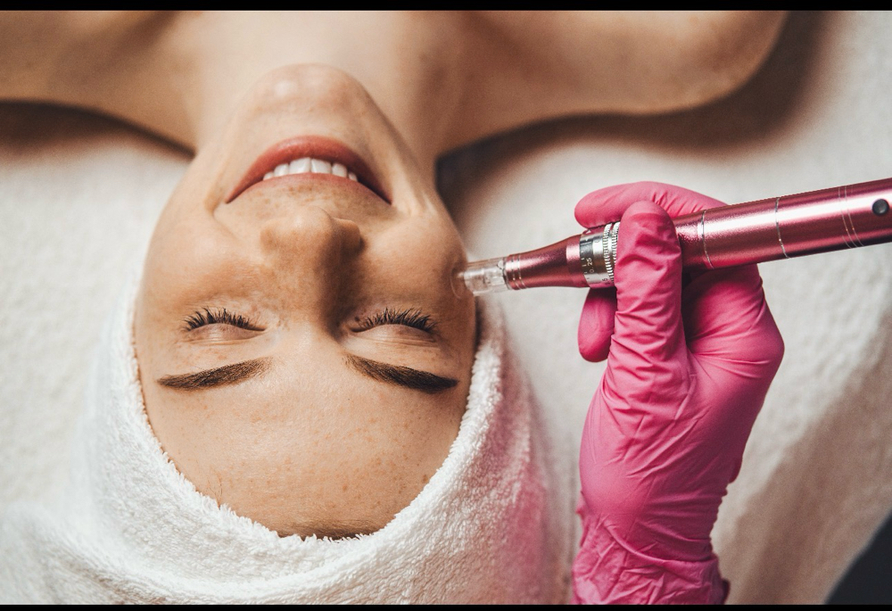Microneedling at Aurora Glow Aesthetics in Spring, TX