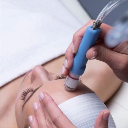 The Hydradermabrasion Facial at Embrace Skin Studio | Facials in San Francisco's Inner Richmond in San Francisco, CA