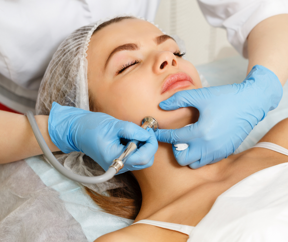 Microdermabrasion