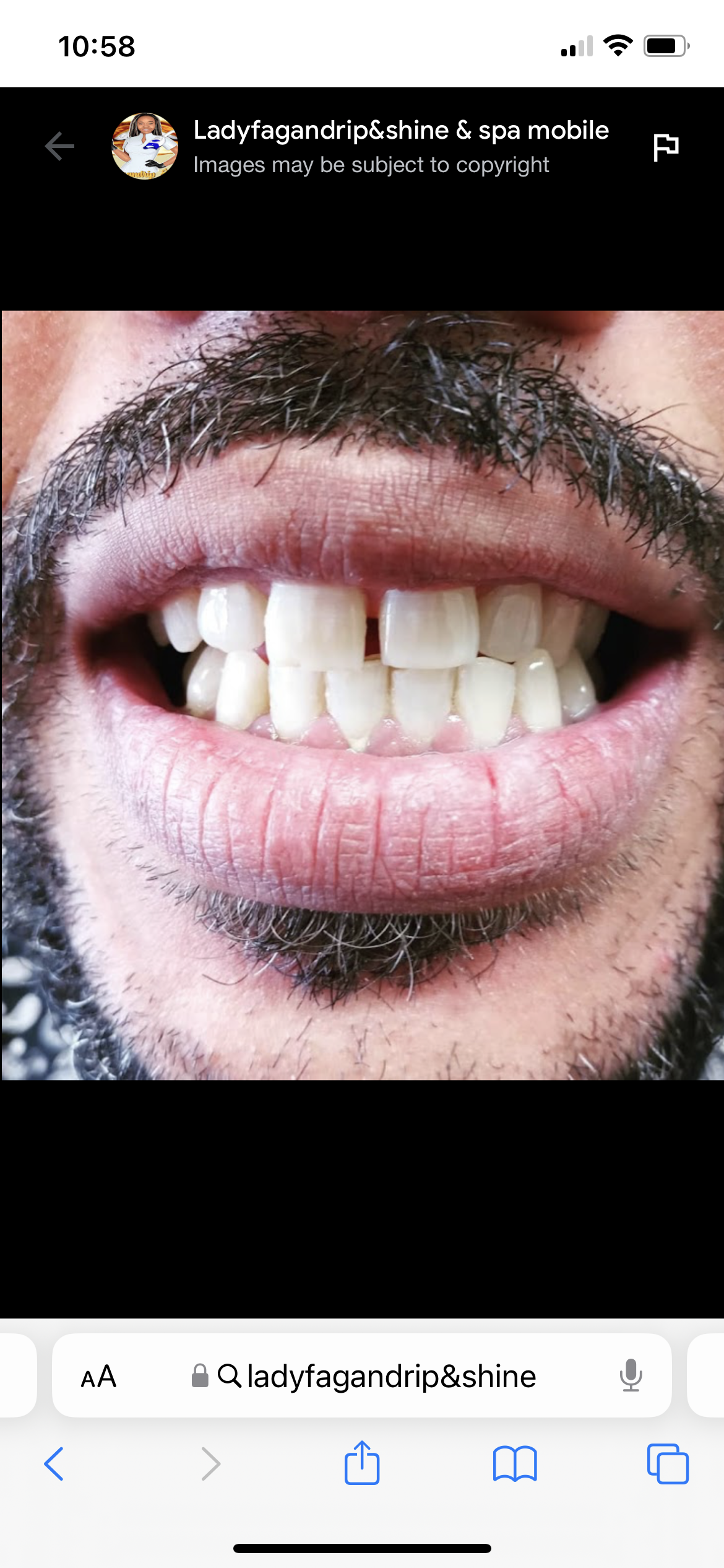 4 sessions teeth whitening