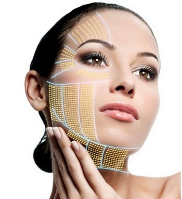 Lifting Facial Full Face & Neck