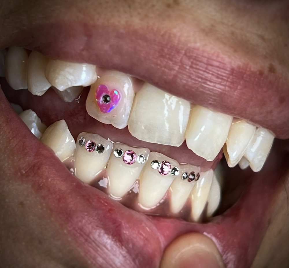 Full Grill