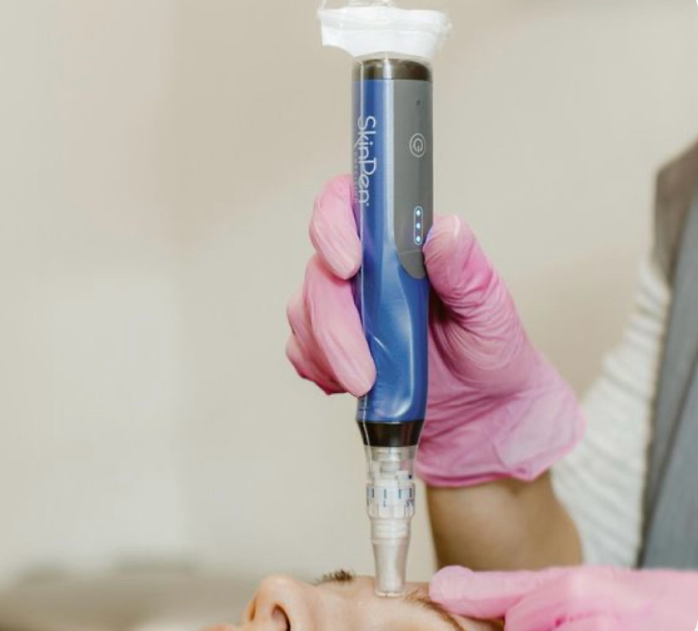 SkinPen Microneedling