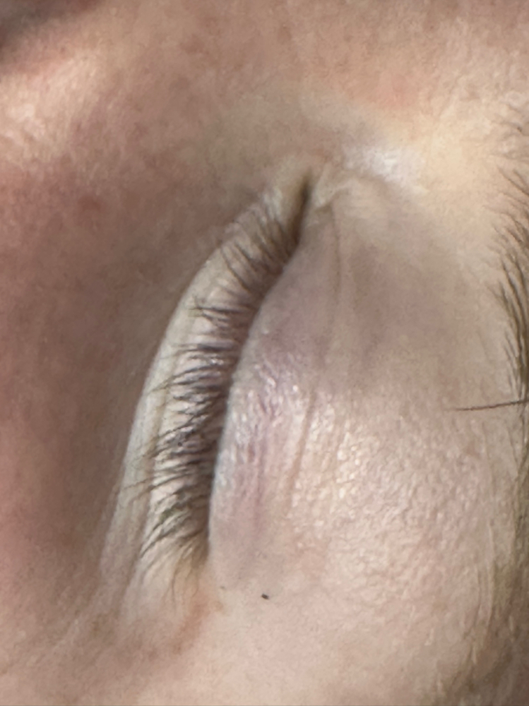 Lash Removal