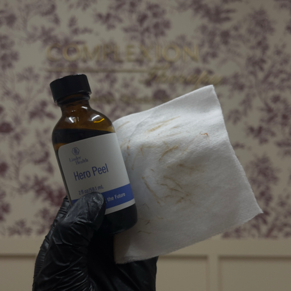 Chemical Peel at Complexion Therapy in Kennewick, WA
