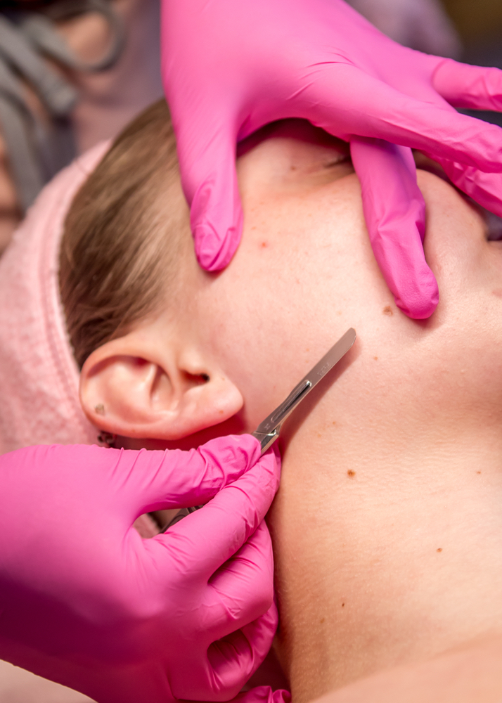 Dermaplane Facial