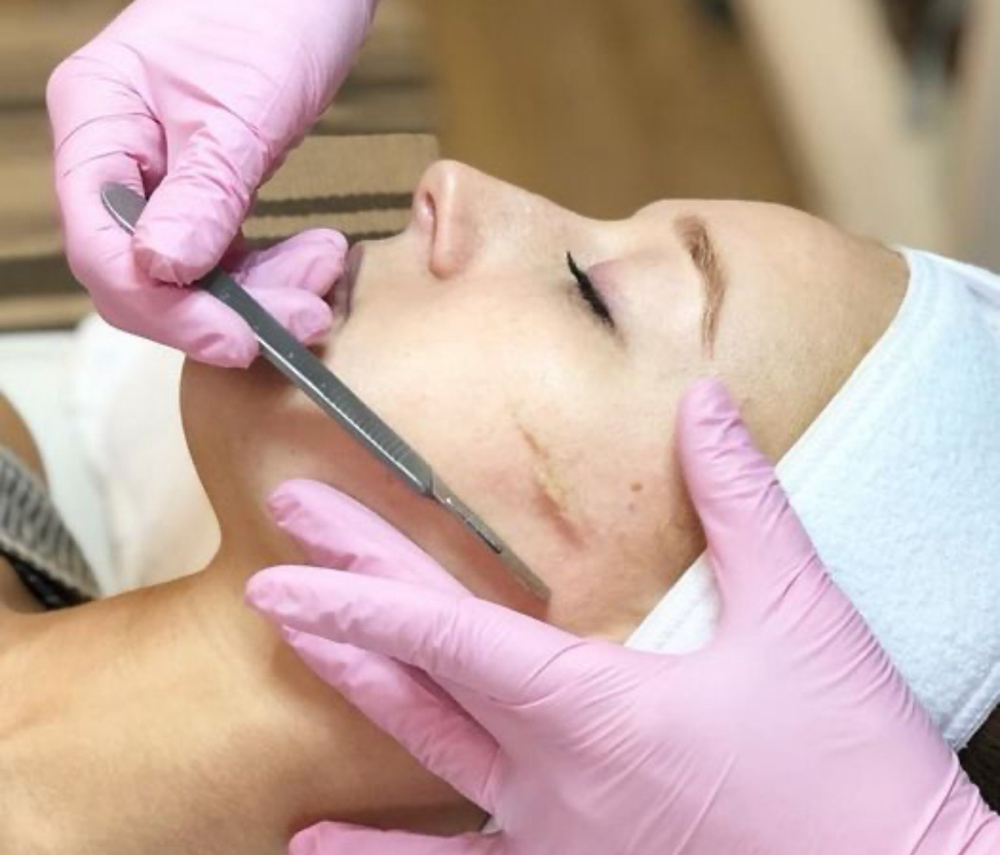 Dermaplaning With Oxygen Infusion