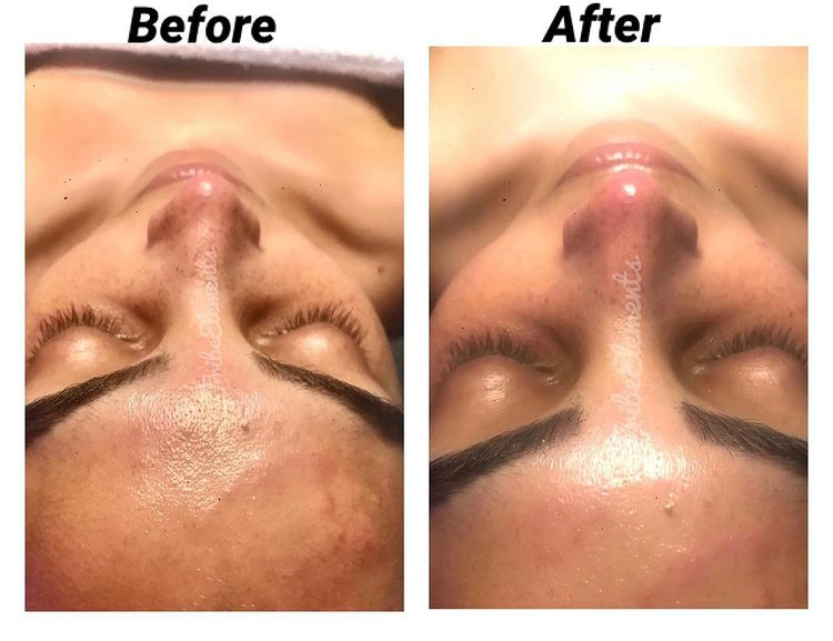 The Elements Clear skin Facial