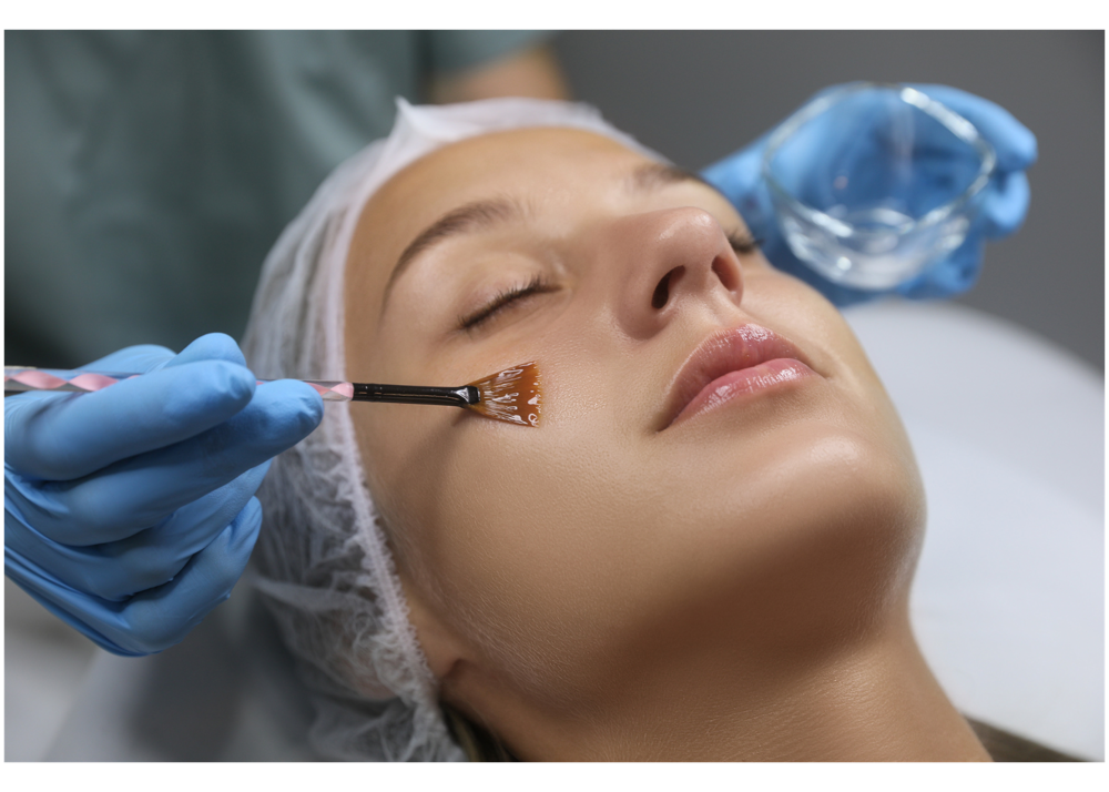 Advanced Chemical Peel Treatment