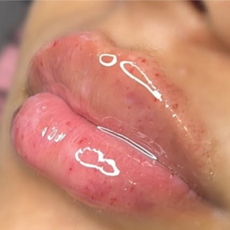 Pillow Pout 💋 | 1.5 mL at CurvSculpt in Denver, CO