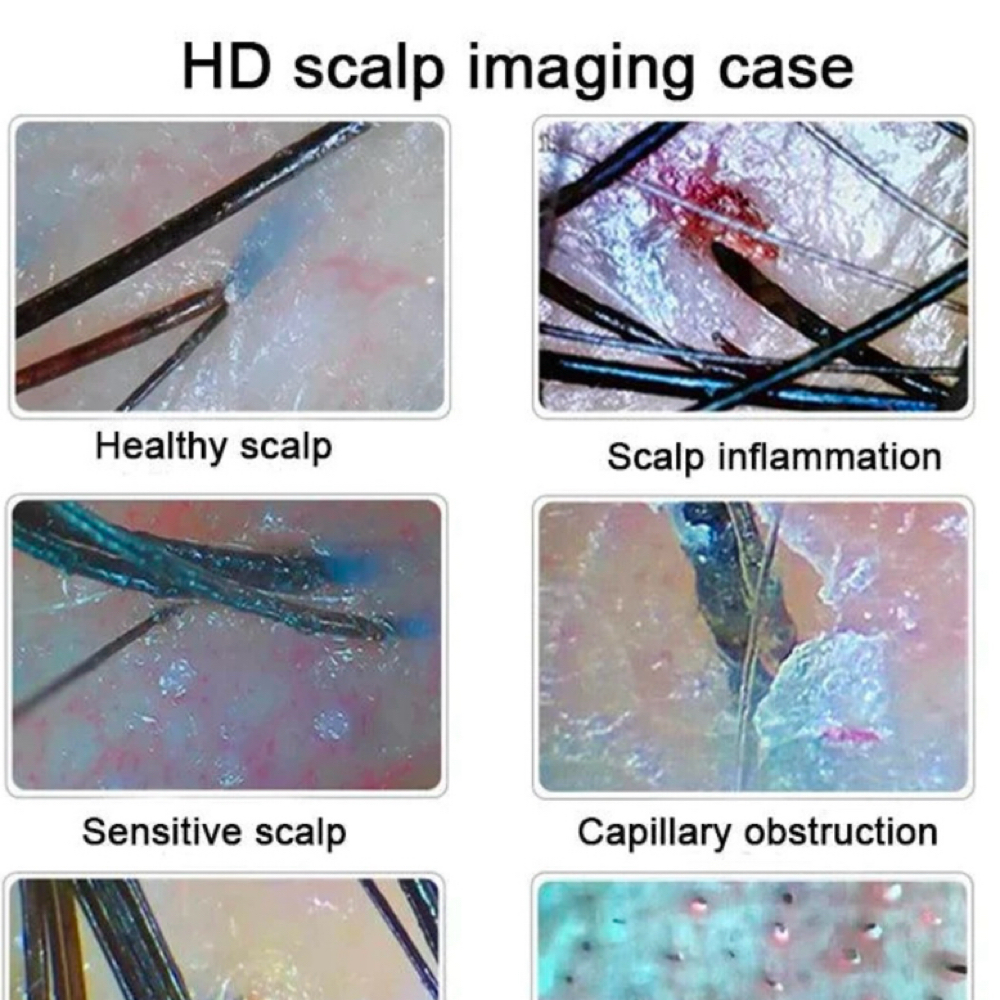 Scalp Analysis at TouchedByTyBeautyCo in San Antonio, TX