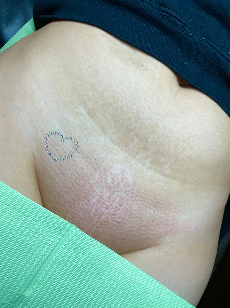 Vajazzle Add-on
