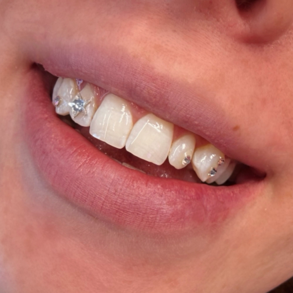 TOOTH GEMS at The Iconic Parlour in Twentynine Palms, CA