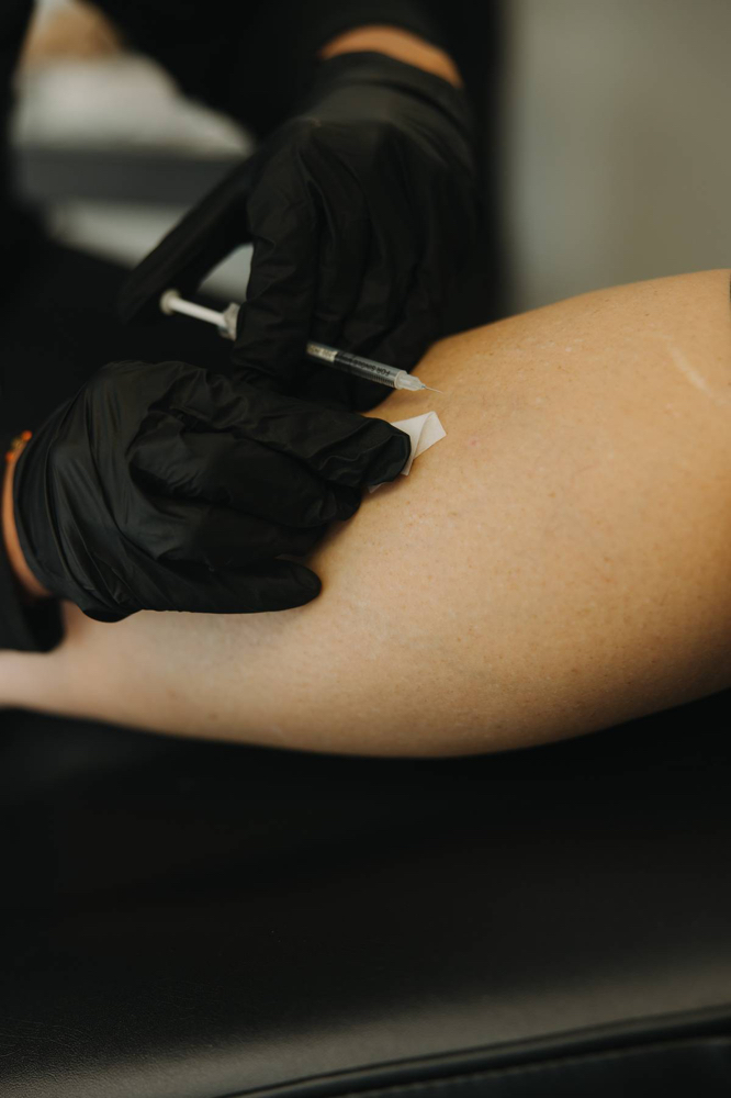 Spider Vein Treatment at By Grace Aesthetics & Wellness in Oneida, TN