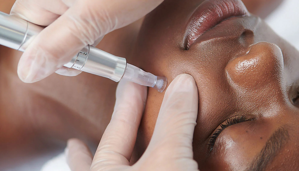Advanced Glow Facial at Eury’s Glow Esthetics in Methuen, MA