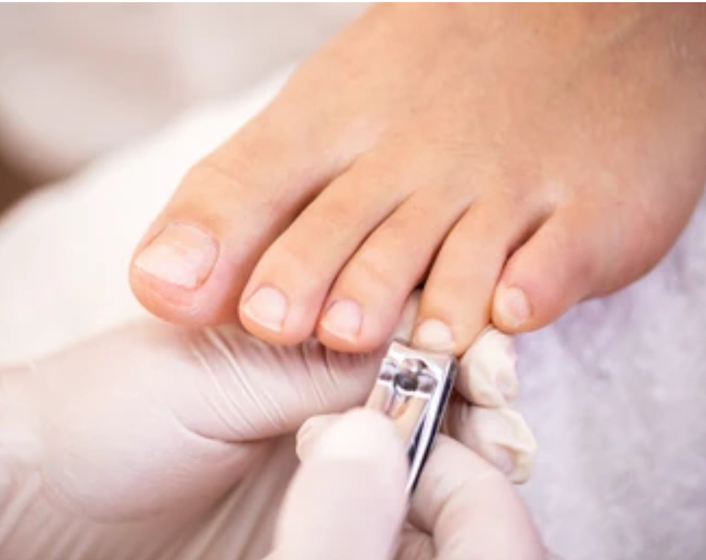 Nail Cut On Toes