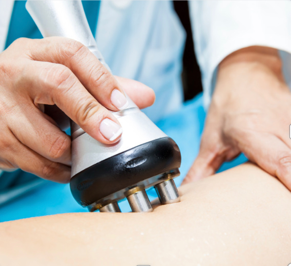 RadioFrequency at Yesenia Venegas in Chicago, IL