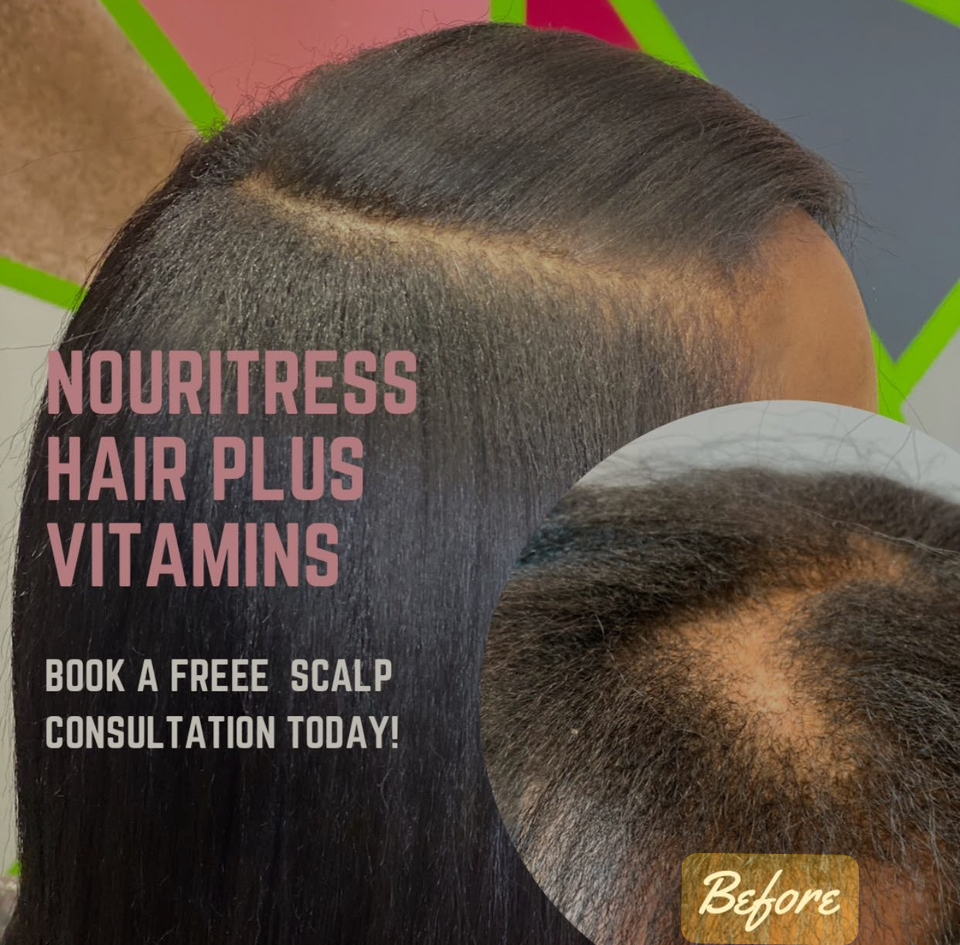 Hair Loss Preventiom