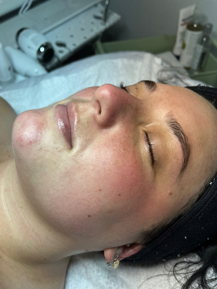 Preteen Facial (12years-17years)