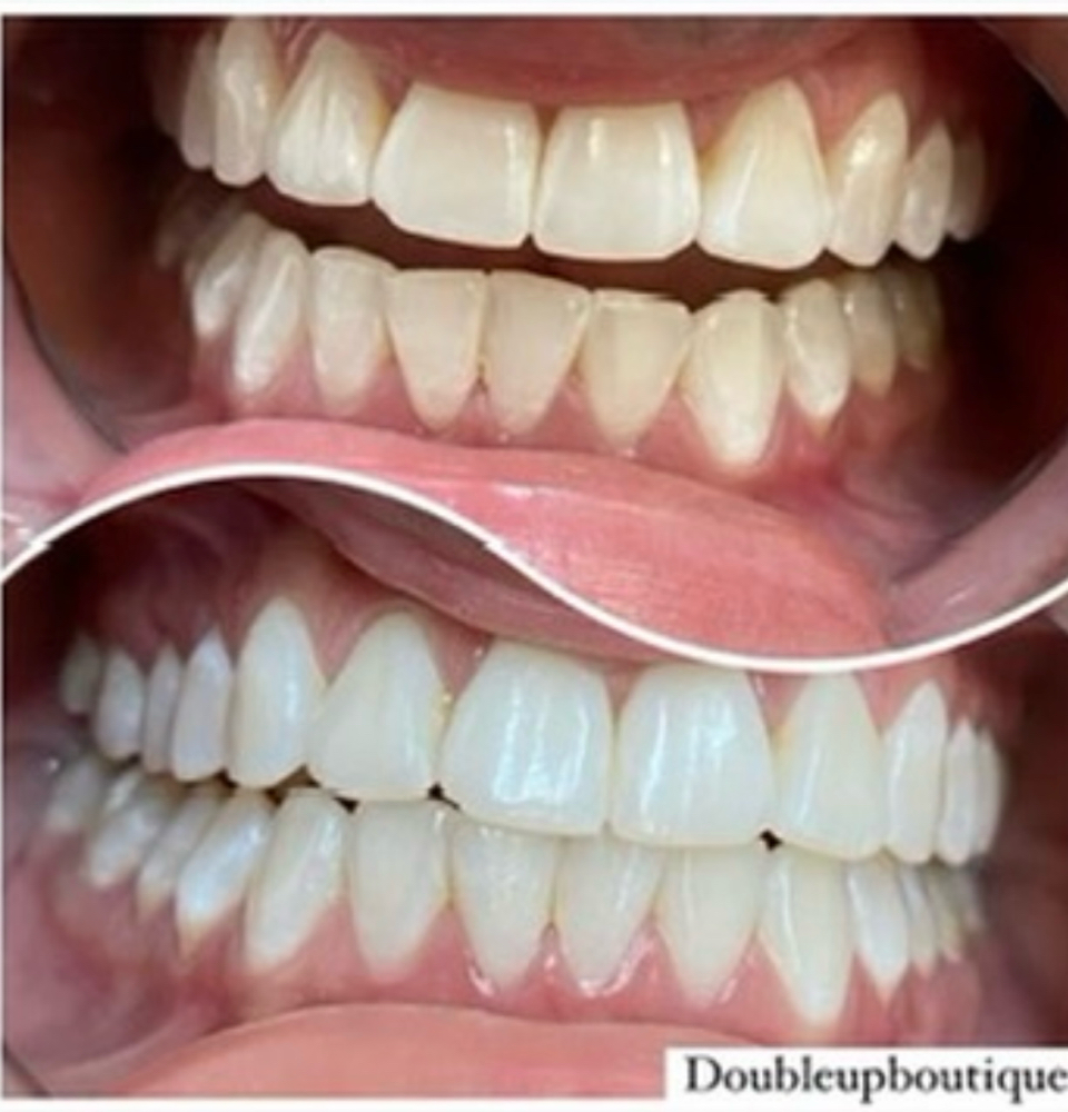 90 Minute Teeth Whitening at Double Up Boutique in Warwick, RI