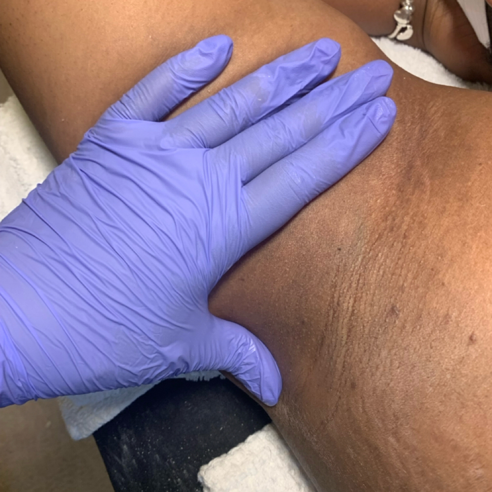 Axilla (underarm) Hair Removal at Sincerely Pure Skincare in Atlanta, GA